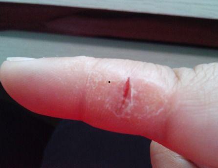 吃瓜伤口流水图片,探究吃瓜伤口流水的奥秘