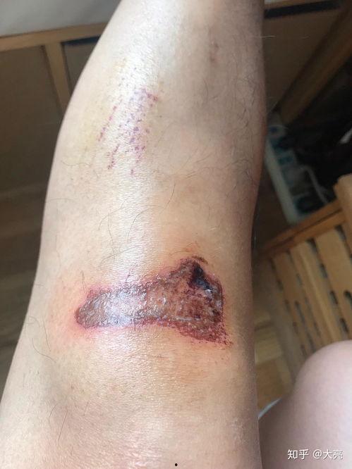 吃瓜伤口流水图片,探究吃瓜伤口流水的奥秘