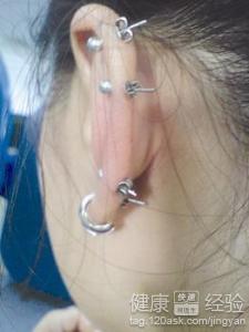 打了耳洞可以吃瓜吗