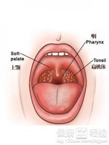 喉炎可以吃小瓜吗,缓解不适